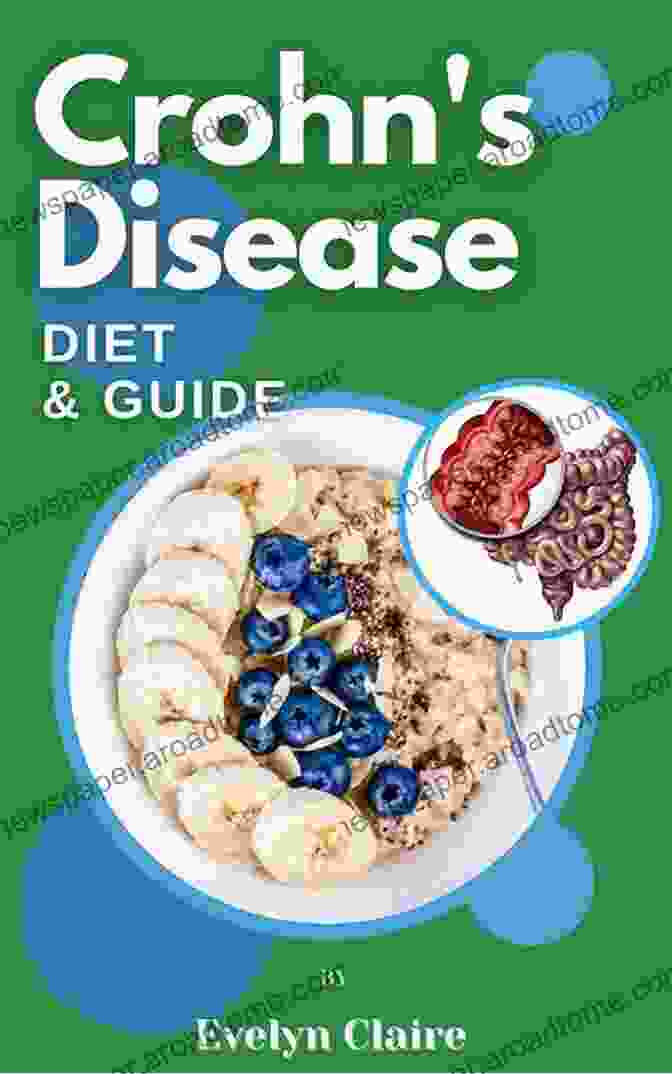 Crohn's Disease Comprehensive Diet Guide And Cookbook, Featuring A Colorful Cover With Healthy Ingredients And A Smiling Woman Holding A Salad Crohn S Disease Comprehensive Diet Guide And Cook Book: More Than130 Recipes And 75 Essential Cooking Tips For Crohn S Patients (Autoimmune Disease 2)