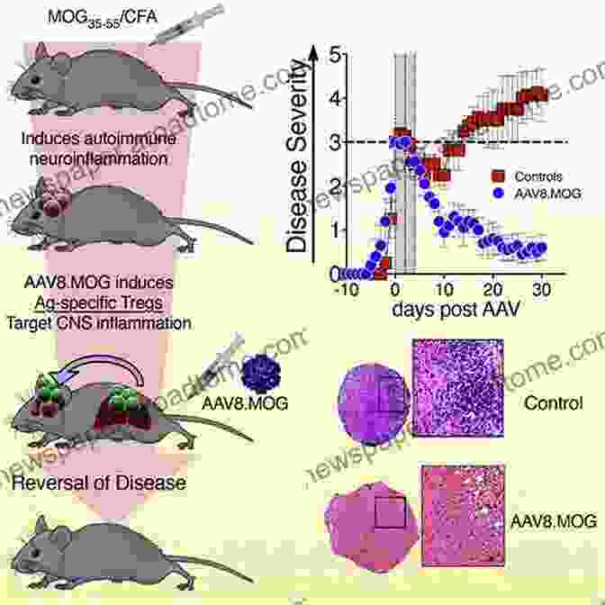 Mouse Model Of Multiple Sclerosis Research Experimental Models Of Multiple Sclerosis