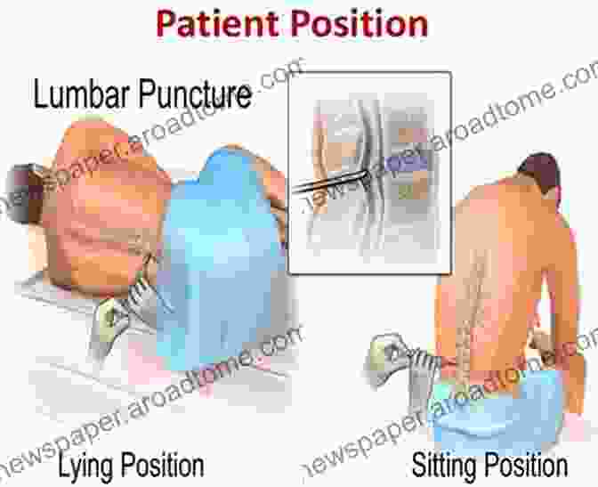 Multiple Puncture Skin Testing Being Performed On A Patient's Back Quantitative Skin Testing For Allergy: IDT And MQT