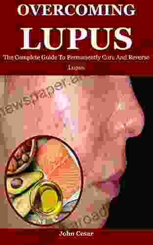 Overcoming Lupus: The Complete Guide To Permanently Cure And Reverse Lupus