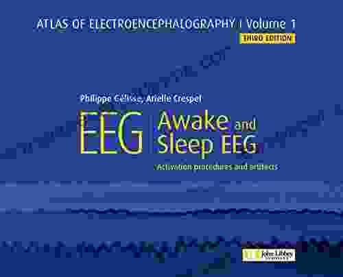 Atlas Of Electroencephalography : Awake And Sleep EEG: Activation Procedures And Artifacts (Atlas EEG 1)