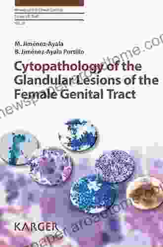 Cytopathology Of The Glandular Lesions Of The Female Genital Tract (Monographs In Clinical Cytology 20)